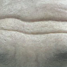 이마 주름