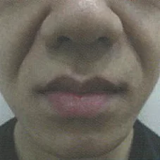 팔자 주름